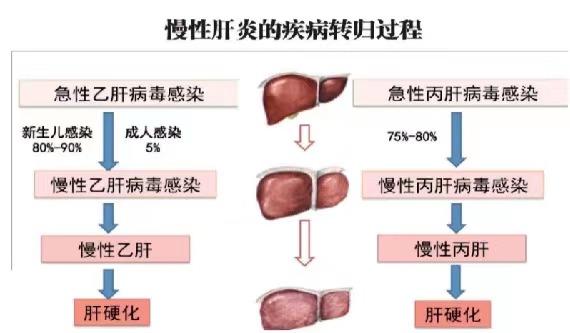 【健康科普】世界肝炎日——堅持早預防，加強檢測發(fā)現(xiàn)，規(guī)范抗病毒治療